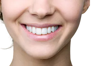 اصلاح طرح لبخند